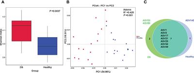 Profiling Blautia at high taxonomic resolution reveals correlations with cognitive dysfunction in Chinese children with Down syndrome